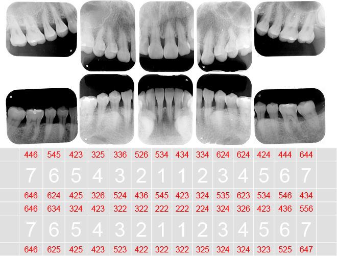 多くの歯のレントゲンや資料を保存、比較し意深くメンテナンスを行っていきます