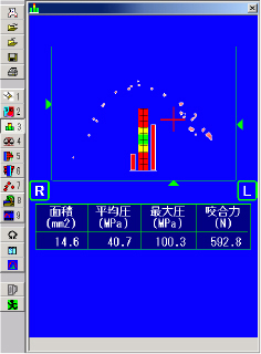 噛み合わせを色々な角度からチェックします